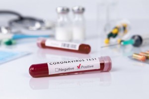 Blood test tube with the Coronavirus disease for virus test and